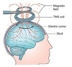 مراحل درمان بیماری های روانی
