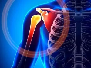 علائم فیبرومیالژی