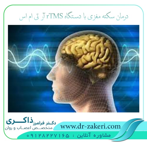 درمان سکته مغزی با دستگاه rTMS آر تی ام اس