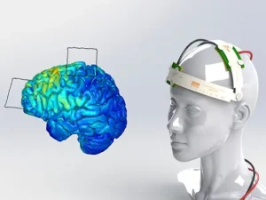 درمان اضطراب با تی دی سی اس